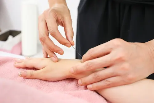肘や手首に針を打つ